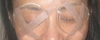 lasik.jpg